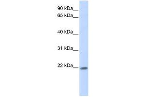 WB Suggested Anti-ZNF534 Antibody Titration:  0. (ZNF534 antibody  (Middle Region))