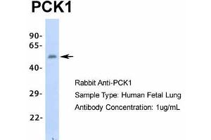 Western Blotting (WB) image for anti-phosphoenolpyruvate Carboxykinase 1 (Soluble) (PCK1) (Middle Region) antibody (ABIN2777602)