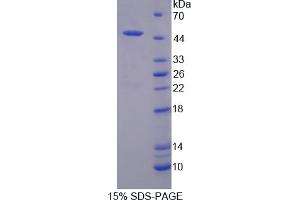 Image no. 1 for Platelet-Activating Factor Acetylhydrolase 2, 40kDa (PAFAH2) (AA 1-392) protein (His tag) (ABIN4988980) (PAFAH2 Protein (AA 1-392) (His tag))