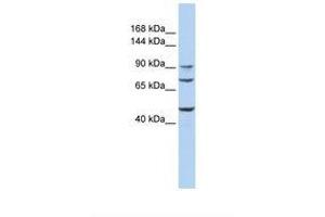 Image no. 1 for anti-UDP-N-Acetyl-alpha-D-Galactosamine:polypeptide N-Acetylgalactosaminyltransferase 5 (GalNAc-T5) (GALNT5) (AA 701-750) antibody (ABIN6738301) (GALNT5 antibody  (AA 701-750))
