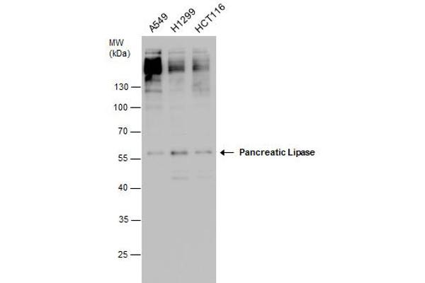 PNLIP antibody