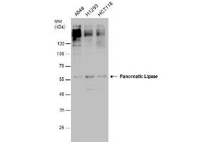 WB Image Pancreatic Lipase antibody detects Pancreatic Lipase protein by western blot analysis. (PNLIP antibody)