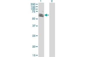 Western Blot analysis of RNF12 expression in transfected 293T cell line by RNF12 monoclonal antibody (M01), clone 1G10.