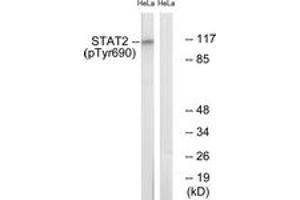 Western blot analysis of extracts from HeLa cells treated with IFN 2500U/ml 30', using STAT2 (Phospho-Tyr690) Antibody. (STAT2 antibody  (pTyr690))