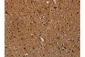 The image on the left is immunohistochemistry of paraffin-embedded Human brain tissue using ABIN7191558(MYBBP1A Antibody) at dilution 1/40, on the right is treated with synthetic peptide. (MYBBP1A antibody)