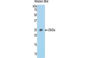 Western blot analysis of the recombinant protein. (SEMA4B antibody  (AA 31-240))