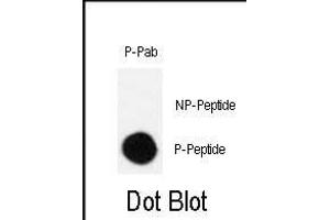 Dot blot analysis of Phospho-CRK-S41 polyclonal antibody (ABIN389702 and ABIN2837929) on nitrocellulose membrane. (Crk antibody  (pSer41))