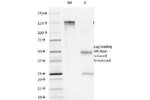 SDS-PAGE Analysis Purified CD1b Mouse Monoclonal Antibody (100-1A5). (CD1b antibody)