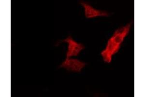 ABIN6274405 staining HepG2 by IF/ICC. (MARK2 antibody  (Internal Region))