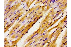 Immunohistochemistry of paraffin-embedded human heart tissue using ABIN7153789 at dilution of 1:100 (GTF2IRD1 antibody  (AA 436-560))