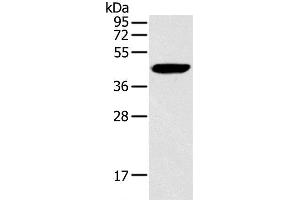 Western Blot analysis of Hela cell using RAD51 Polyclonal Antibody at dilution of 1:200 (RAD51 antibody)