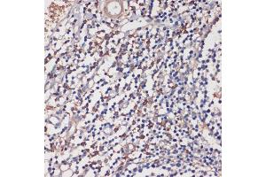 Immunohistochemistry of paraffin-embedded human tonsil using TLR5 antibody (ABIN3022438, ABIN3022439, ABIN3022440 and ABIN6218820) at dilution of 1:100 (40x lens).