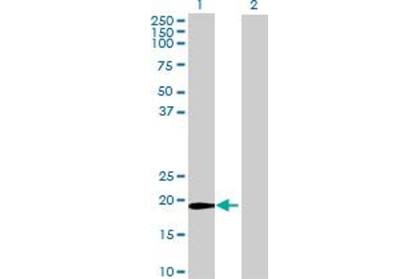 ZFAND1 antibody  (AA 1-161)
