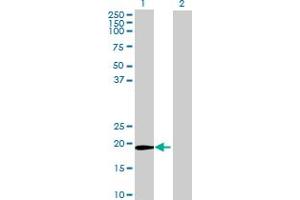 Western Blot analysis of ZFAND1 expression in transfected 293T cell line by ZFAND1 MaxPab polyclonal antibody. (ZFAND1 antibody  (AA 1-161))