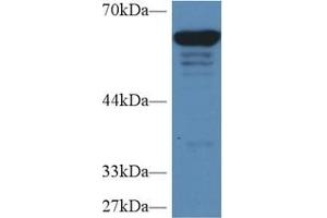 Detection of PKM2 in Human HepG2 cell lysate using Polyclonal Antibody to Pyruvate kinase isozymes M2 (PKM2) (PKM2 antibody  (AA 141-248))