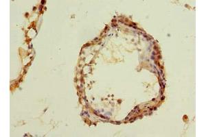 Immunohistochemistry (IHC) image for anti-Minichromosome Maintenance Deficient 9 (MCM9) (AA 1-391) antibody (ABIN7150185)