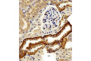 FXYD6 antibody  (C-Term)