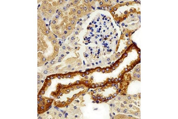 FXYD6 antibody  (C-Term)