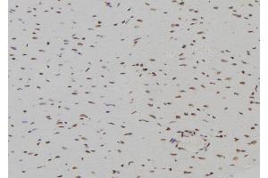 ABIN6277446 at 1/100 staining Rat heart tissue by IHC-P.