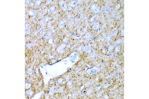 Immunohistochemistry of paraffin-embedded rat brain using PTGDS antibody. (PTGDS antibody)