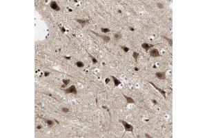 Immunohistochemical staining of human cerebral cortex with FBXO44 polyclonal antibody  shows strong nuclear and cytoplasmic positivity in neuronal cells at 1:200-1:500 dilution.