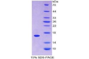 SDS-PAGE (SDS) image for Annexin A3 (ANXA3) (AA 26-160) protein (His tag) (ABIN1098852)