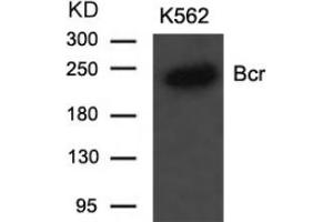 Image no. 2 for anti-Breakpoint Cluster Region (BCR) (Tyr177) antibody (ABIN197421) (BCR antibody  (Tyr177))