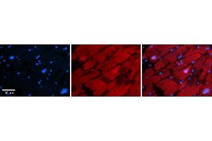 Rabbit Anti-HDAC6 Antibody    Formalin Fixed Paraffin Embedded Tissue: Human Adult heart  Observed Staining: Cytoplasmic,Nuclear Primary Antibody Concentration: 1:600 Secondary Antibody: Donkey anti-Rabbit-Cy2/3 Secondary Antibody Concentration: 1:200 Magnification: 20X Exposure Time: 0. (HDAC6 antibody  (N-Term))