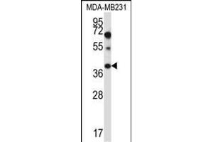 PTPLA Antibody (N-term) (ABIN657409 and ABIN2846449) western blot analysis in MDA-M cell line lysates (35 μg/lane). (PTPLA antibody  (N-Term))