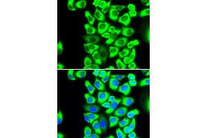 Immunofluorescence analysis of MCF-7 cells using RPS3A antibody (ABIN5973489). (RPS3A antibody)