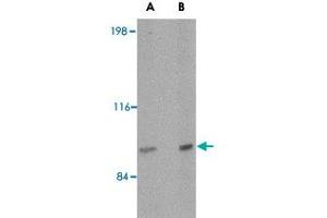 Western blot analysis of SATB2 in mouse brain tissue lysate with SATB2 polyclonal antibody  at (A) 2 and (B) 4 ug/mL . (SATB2 antibody  (N-Term))