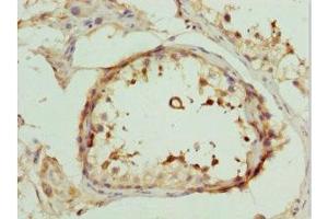 Immunohistochemistry of paraffin-embedded human testis tissue using ABIN7149547 at dilution of 1:100 (DEDD antibody  (AA 1-318))