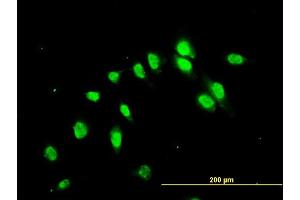Immunofluorescence of monoclonal antibody to C17orf75 on HeLa cell. (C17orf75 antibody  (AA 1-396))