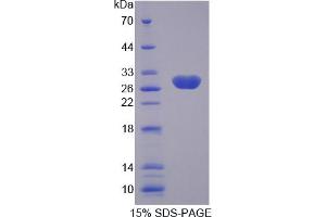 Image no. 1 for Kallikrein-Related Peptidase 4 (KLK4) (AA 27-254) protein (His tag) (ABIN6236648) (Kallikrein 4 Protein (AA 27-254) (His tag))