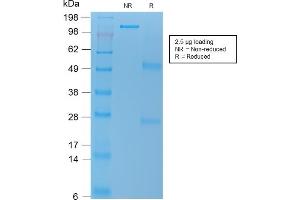 SDS-PAGE Analysis Purified VEGI Mouse Recombinant Monoclonal Antibody (rVEGI /1283). (Recombinant TNFSF15 antibody)