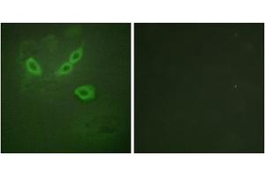Immunofluorescence analysis of HeLa cells, using TUSC5 antibody. (TUSC5 antibody  (N-Term))