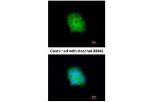 ICC/IF Image Immunofluorescence analysis of methanol-fixed A431, using Amisyn, antibody at 1:200 dilution. (STXBP6 antibody  (N-Term))