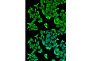 Immunofluorescence analysis of HeLa cells using PSMD9 antibody (ABIN5973093).