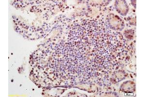 Formalin-fixed and paraffin embedded mouse intestine labeled with Rabbit Anti SETBP1 Polyclonal Antibody, Unconjugated (ABIN1387587) at 1:200 followed by conjugation to the secondary antibody and DAB staining (SETBP1 antibody  (AA 501-600))