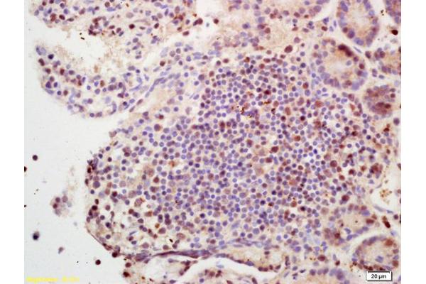 SETBP1 antibody  (AA 501-600)