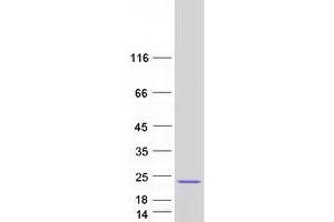 Eukaryotic Translation Initiation Factor 5A (EIF5A) (Transcript Variant D) protein (Myc-DYKDDDDK Tag)