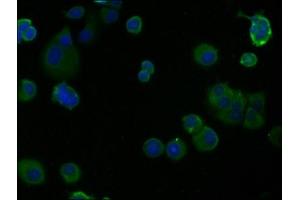 Immunofluorescence staining of MCF-7 cells with ABIN7139771 at 1:100, counter-stained with DAPI. (Caveolin-1 antibody  (AA 26-43))