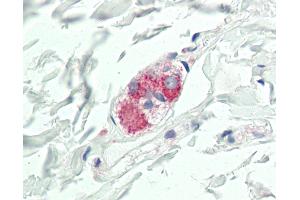 Human Colon, Submucosal Plexus: Formalin-Fixed, Paraffin-Embedded (FFPE) (CYR61 antibody  (AA 47-332))