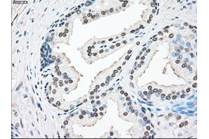 Immunohistochemical staining of paraffin-embedded lung tissue using anti-SSBmouse monoclonal antibody. (SSB antibody)