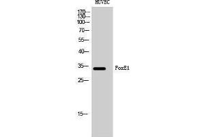 Western Blotting (WB) image for anti-Forkhead Box E1 (Thyroid Transcription Factor 2) (FOXE1) (N-Term) antibody (ABIN3175121) (FOXE1 antibody  (N-Term))