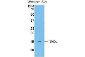 Western Blotting (WB) image for anti-Thymic Stromal Lymphopoietin (TSLP) (AA 75-196) antibody (ABIN1174486) (Thymic Stromal Lymphopoietin antibody  (AA 75-196))