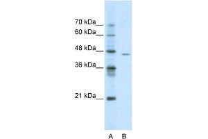 WB Suggested Anti-ACCN4 Antibody Titration:  0. (ACCN4 antibody  (N-Term))