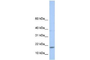 Western Blot showing MAX antibody used at a concentration of 1-2 ug/ml to detect its target protein. (MAX antibody  (N-Term))