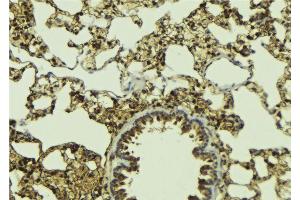 ABIN6268997 at 1/100 staining Mouse lung tissue by IHC-P. (SIAH2 antibody  (C-Term))