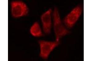 ABIN6274956 staining Hela cells by IF/ICC. (CA1 antibody  (Internal Region))
